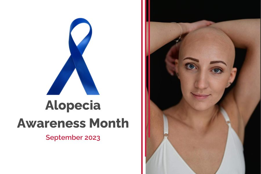 Joseph's Wigs Alopecia Awareness Month Sep23